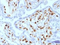 FFPE human placenta sections stained with 100 ul anti-Factor XIIIa (clone SPM180) at 1:50. HIER epitope retrieval prior to staining was performed in 10mM Citrate, pH 6.0.